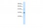 VDAC1 antibody - C-terminal region